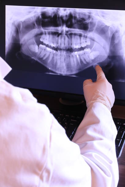 Best Emergency Tooth Extraction in Cross Plains, TN